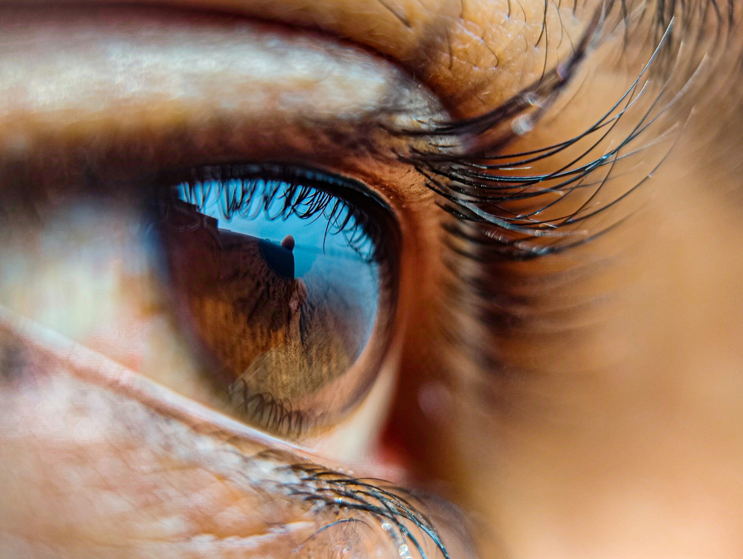 Refractive Cataract Surgery