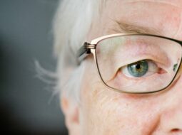 Cataract Surgery