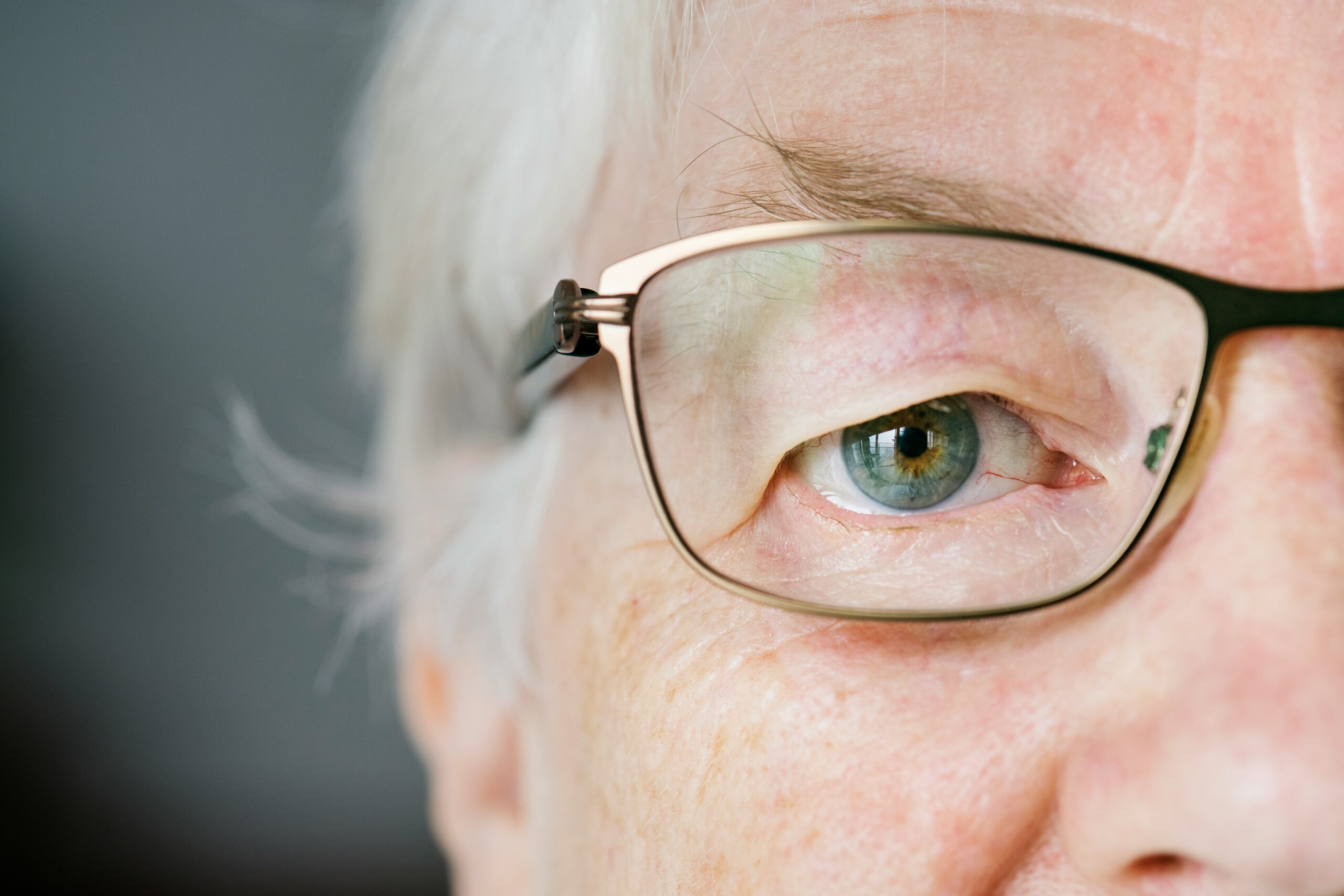 Cataract Surgery