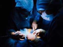 Dr. Kamran Massoumi- Glaucoma Surgery